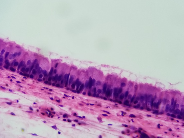 Pseudostratified Epithelium Slides - Pseudostratified Epithelium 17 400X